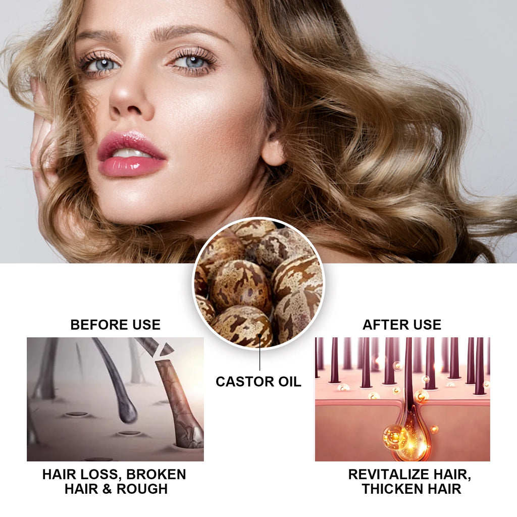 Hoegoa Castor Oil Hair Thickening Essential Oil – 30ml Nourishing Scalp & Growth Serum