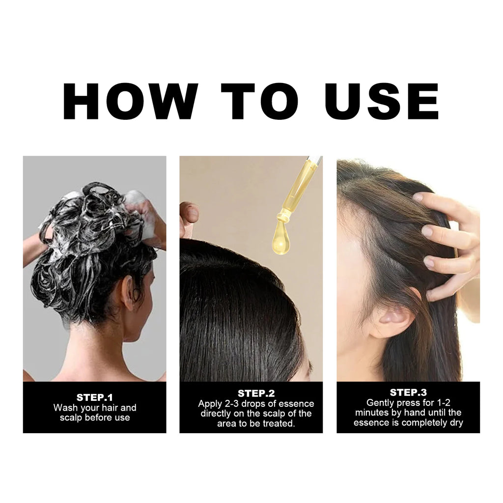 Hoegoa Castor Oil Hair Thickening Essential Oil – 30ml Nourishing Scalp & Growth Serum