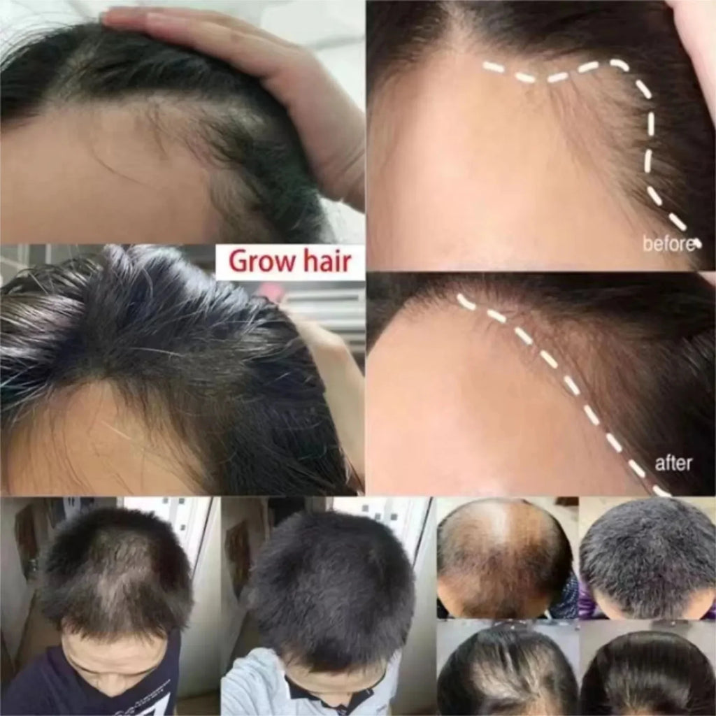 Fast Hair Growth Set Batana Oil Traction Alopecia Hair Mask Anti Break Loss Hair Growth Oil Baldness Treatment Hair Health Care