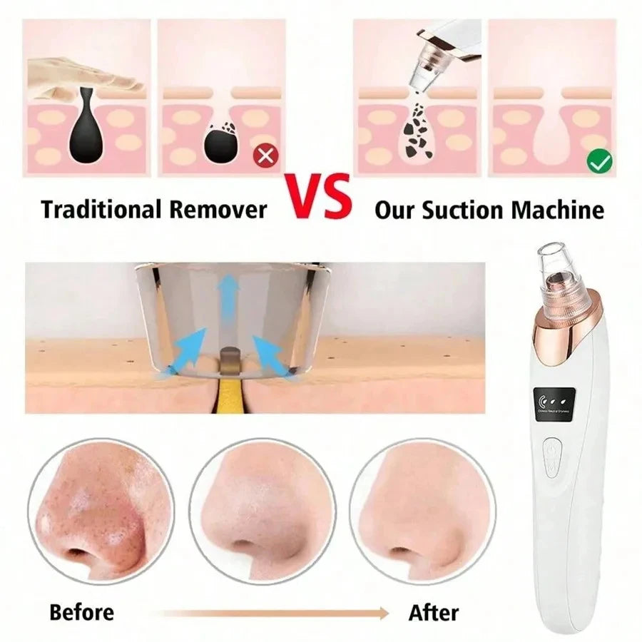 Electric Pore Cleaner & Blackhead Remover - Deep Cleansing Vacuum Device for Facial Care Face Skin Care Tools
