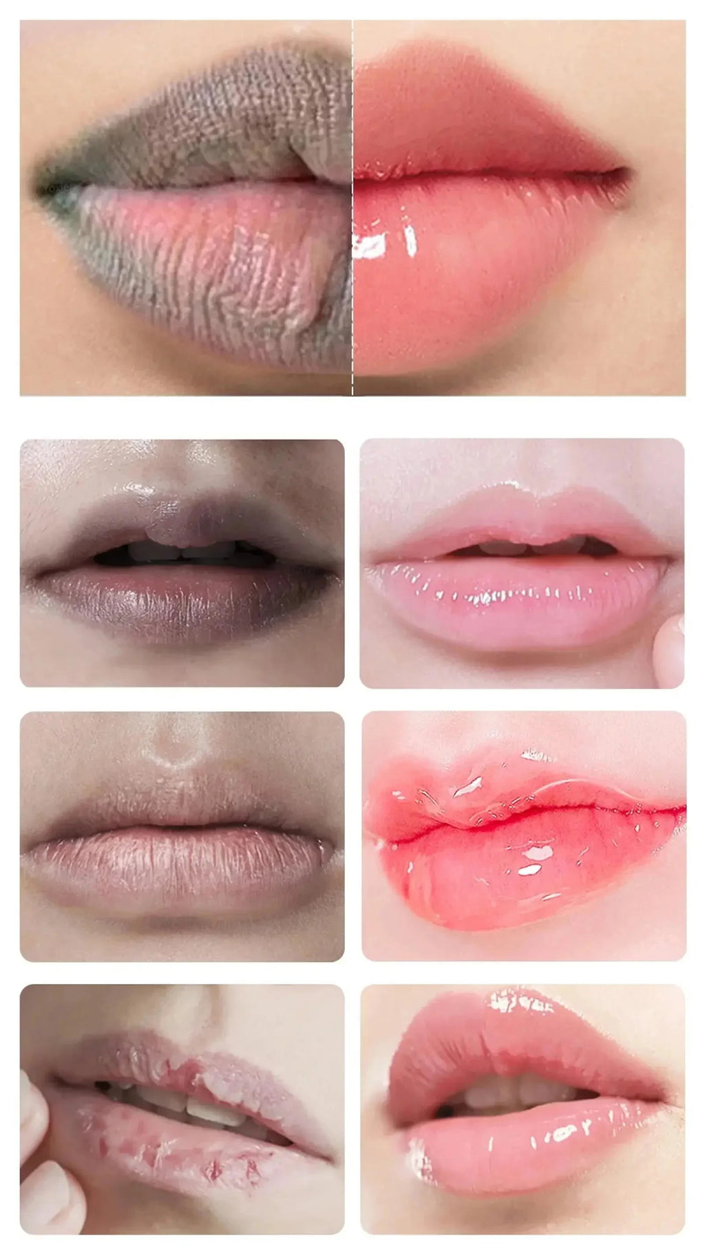 Remove Dark Lip Balm Fast Lightening Pink Lip Exfoliating Fade Lip Line Dead Skin Moisturizer Korean Care Products Beauty Health