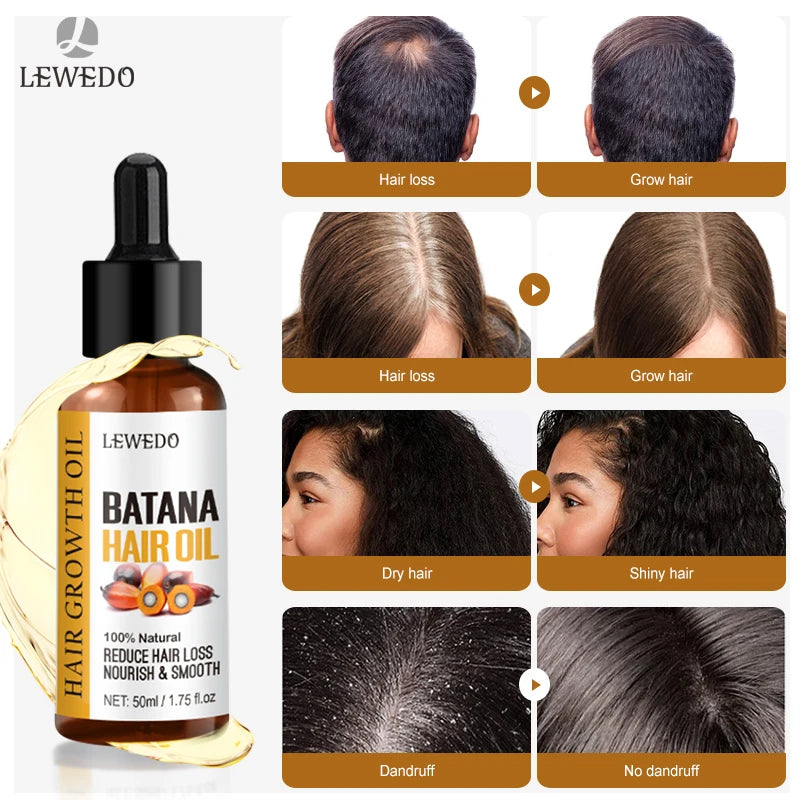 Hair Growth Batana Oil Serum Fast Growing Hair Essential Oil Beauty Hair Care Anti-Hair Loss Essence Natural Repair Damaged Hair