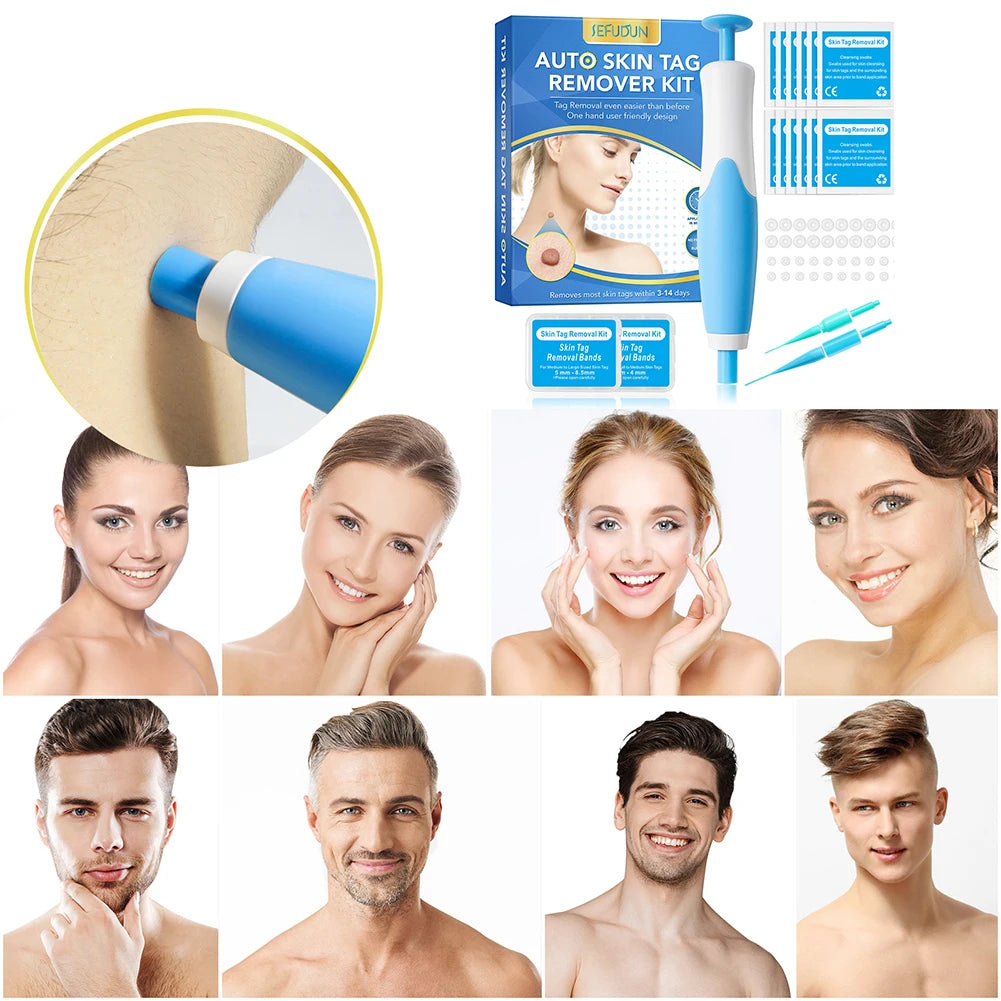 2 IN 1 Auto Micro Skin Tag Remover Device Standard And Micro Skin Tag Removal Kit Adult Mole Wart Remover Face Care Beauty Tools