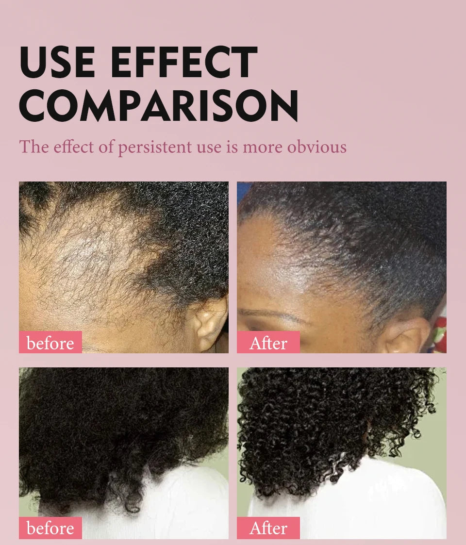 Fast Hair Growth Set – Batana Oil & Hair Mask for Traction Alopecia, Anti-Breakage & Baldness Repair (120g + 50ml)