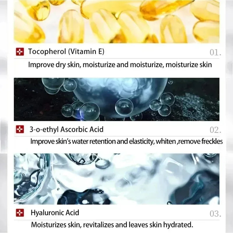 1/3/5pcs Whitening Freckle Cream Niacinamide Remove Dark Spot Cream Anti Freckle and Aging Cream Fade Pigmentation Melasma Skin