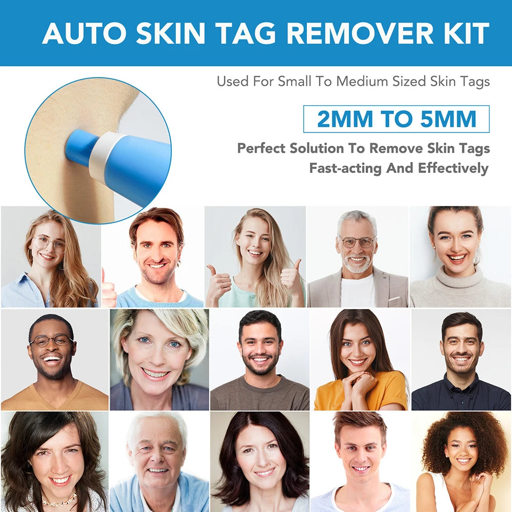 2 IN 1 Auto Micro Skin Tag Remover Device Standard And Micro Skin Tag Removal Kit Adult Mole Wart Remover Face Care Beauty Tools