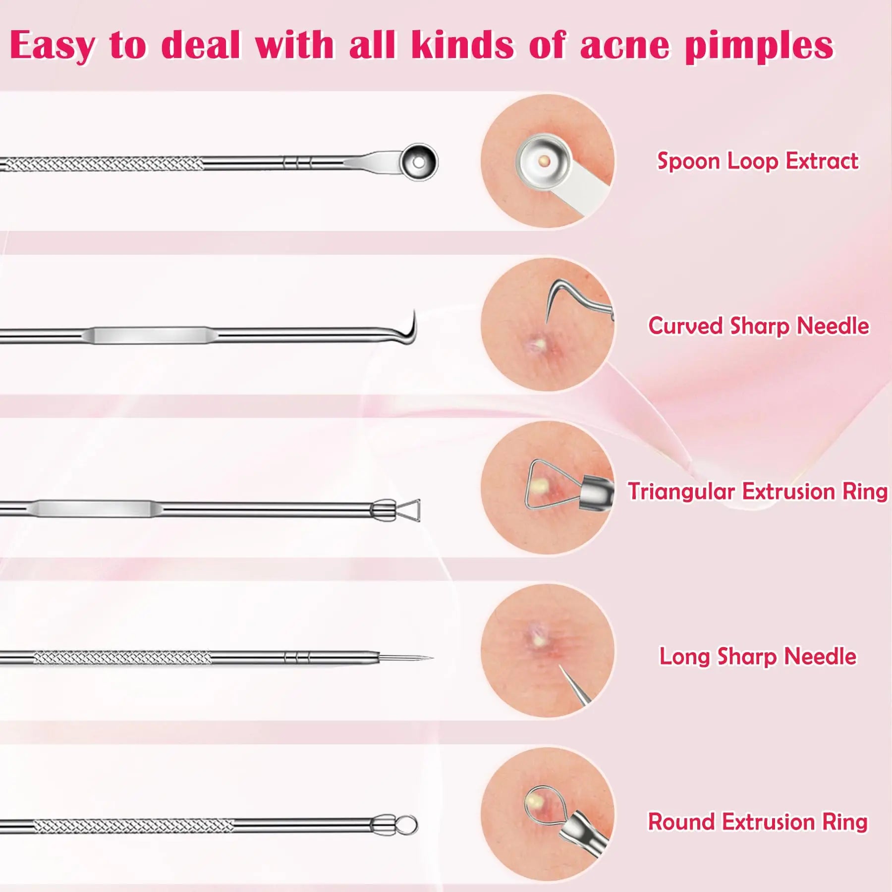 Silver 4-Pack Blackhead Remover Comedones Extractor Removal Kit - For Blemishes, Whiteheads Removal Facial Skin Care (With Box)