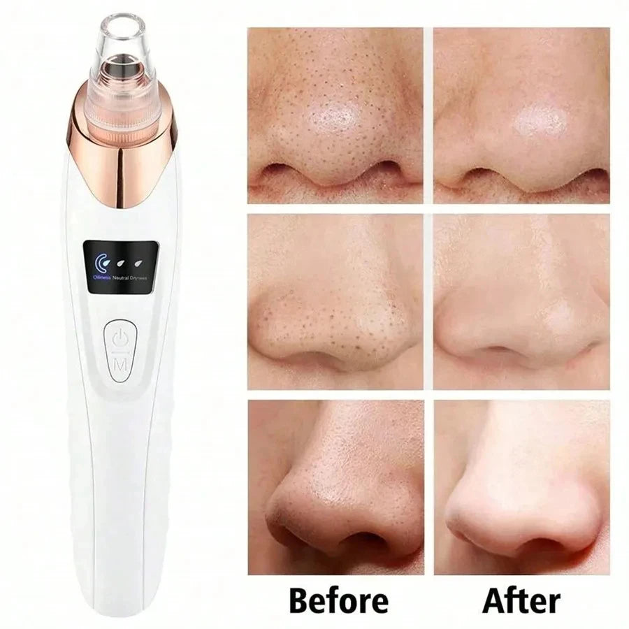 Electric Pore Cleaner & Blackhead Remover - Deep Cleansing Vacuum Device for Facial Care Face Skin Care Tools