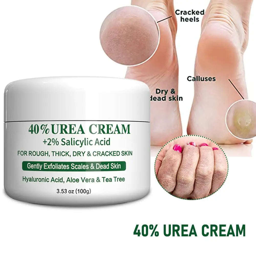 Urea Hand and Foot Cream Softens And Moisturizes Skin Relieves Dryness Repairs Cracks Exfoliates Dead Body Skin Moisturizing