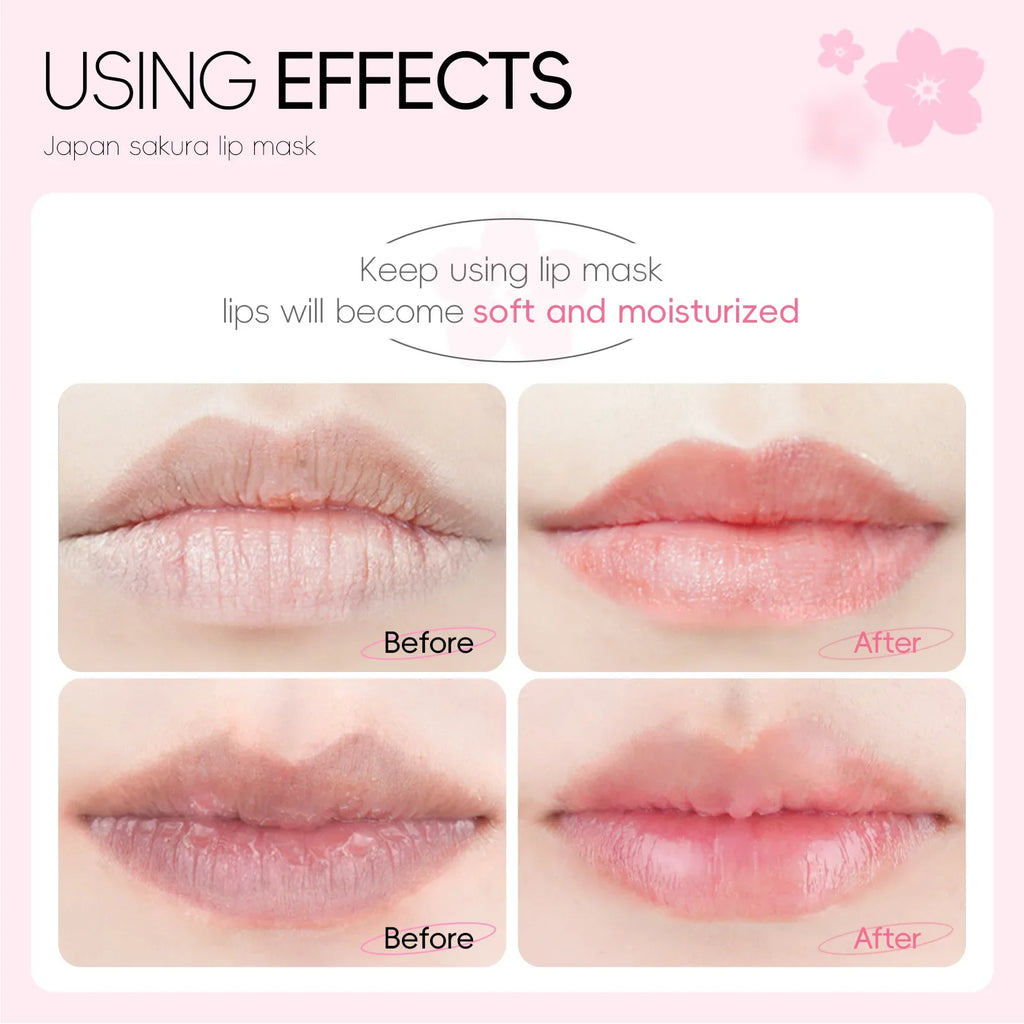 LAIKOU 5/10pcs Lip Mask Lip Care Moisturizing Hydrating Repair Lighten Lip Lines Labial Gel Patch Lips Pad Patches Care Products