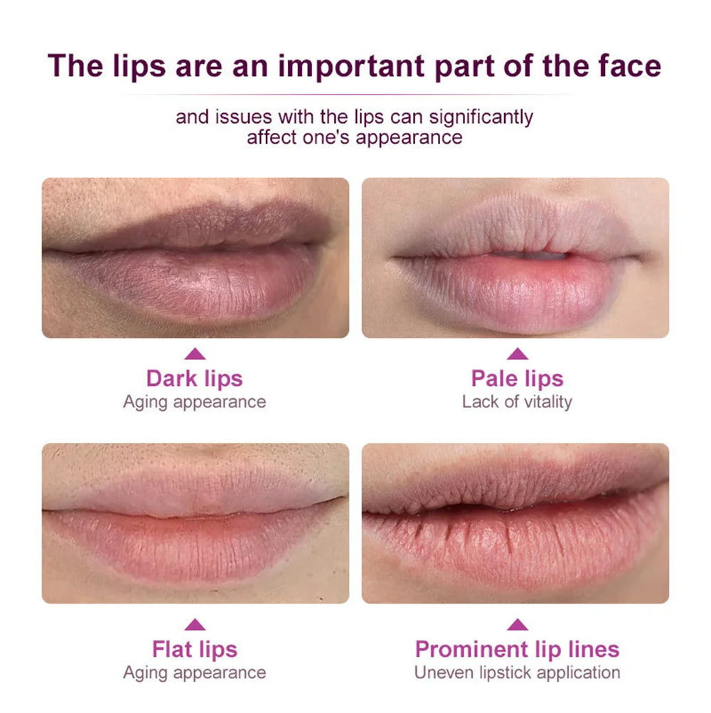 Remove Dark Lip Balm Fast Lightening Pink Lip Exfoliating Fade Lip Line Dead Skin Moisturizer Korean Care Products Beauty Health