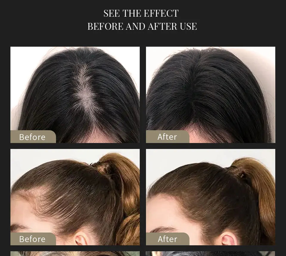 SEVICH Keratin Hair Fiber Set – Covers Sparse Hair & Bald Spots (25g)