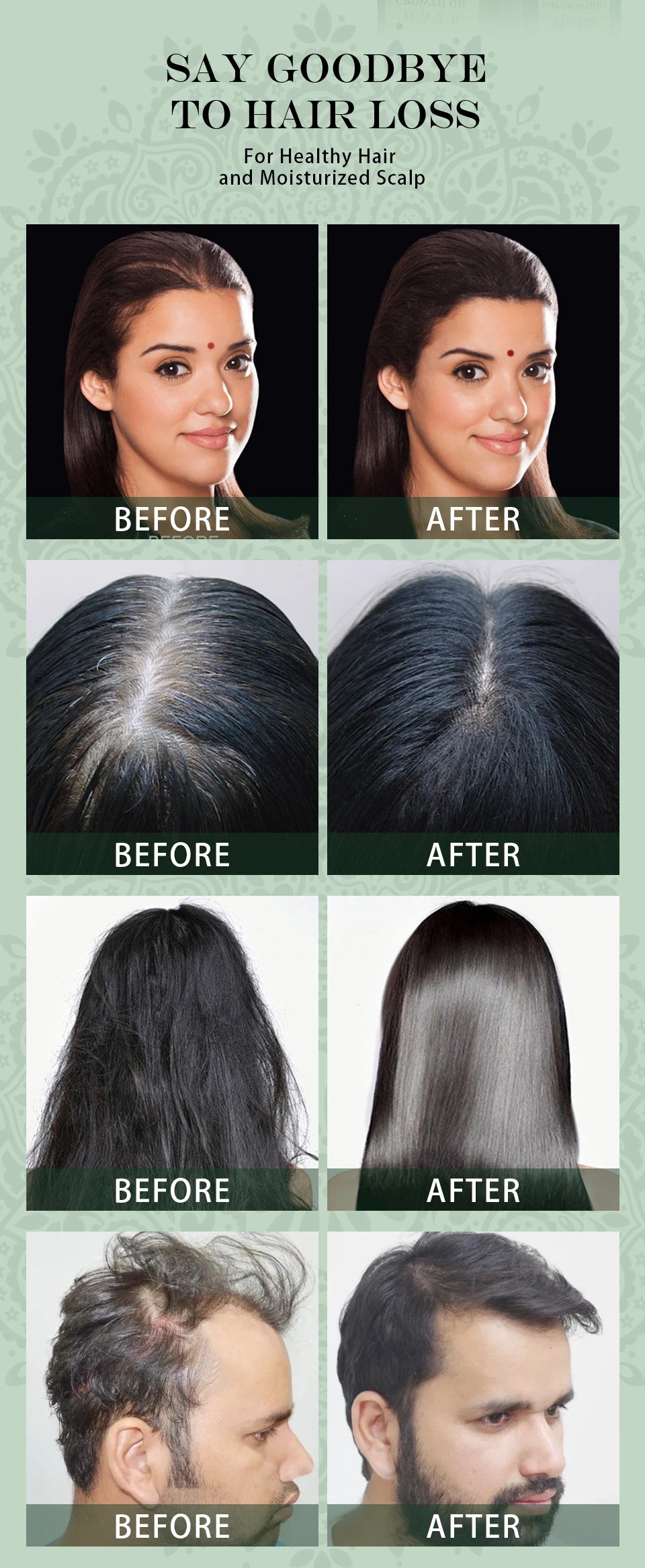 Sevich Ayurvedic Hair Growth Oil – 50ml Adivasi Organic Coconut Oil Serum for Fast Regrowth & Anti-Hair Loss