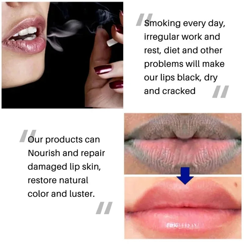 Lips Darkness Removal Lip Balm Lightening Melanin Mask Lipgloss Oil Exfoliating Clean Moisturizer Makeup Beauty Beauty-y-health
