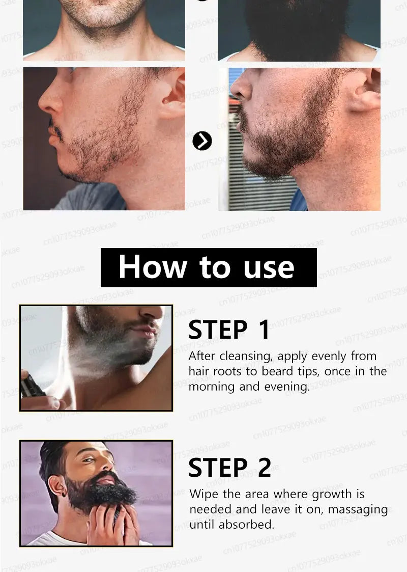 Beard & Hair Growth Essence – Root Care Serum (30ml)