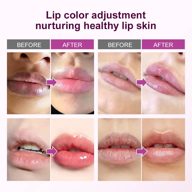 Remove Dark Lip Balm Fast Lightening Pink Lip Exfoliating Fade Lip Line Dead Skin Moisturizer Korean Care Products Beauty Health