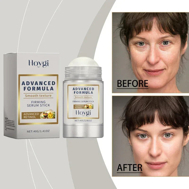 Retinol + Hyaluronic Acid Face Balm Stick – Anti-Wrinkle, Firming & Moisturizing Korean Skincare for Smooth, Plump, Youthful Skin