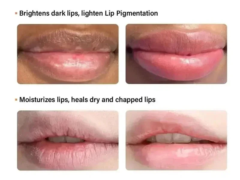 Remove Dark Lip Balm Moisturizing Lighten Melanin Bleaching Lip Gloss Lip Pink Lipstick Exfoliating Fade Lip Line Beauty Health