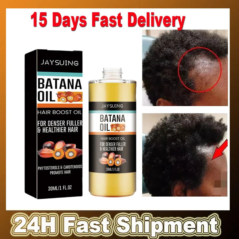 Jaysuing Fast Hair Growth Set – Batana Oil & Hair Mask for Traction Alopecia, Anti-Breakage & Baldness Repair (30ml)