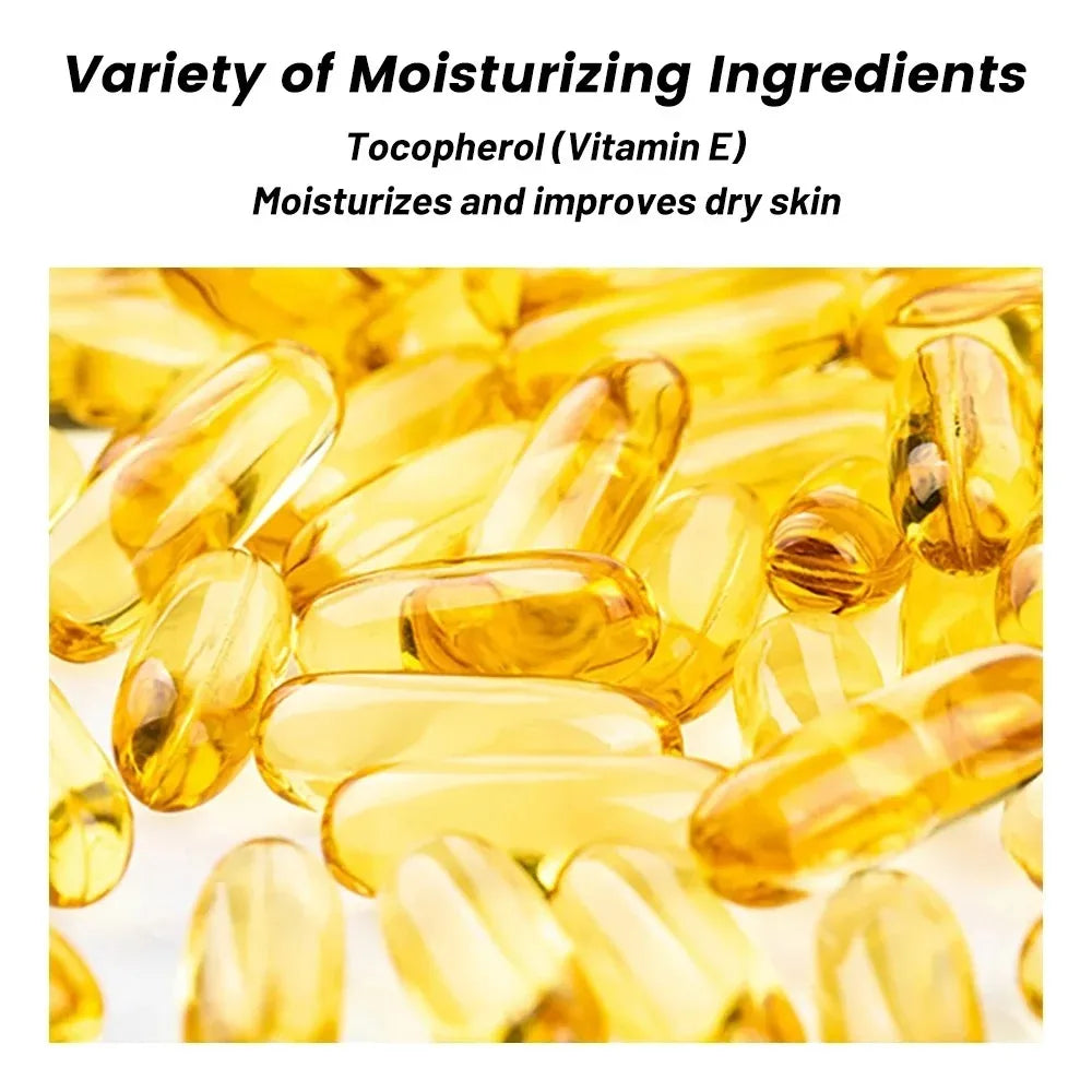 1/3/5pcs Whitening Freckle Cream Niacinamide Remove Dark Spot Cream Anti Freckle and Aging Cream Fade Pigmentation Melasma Skin