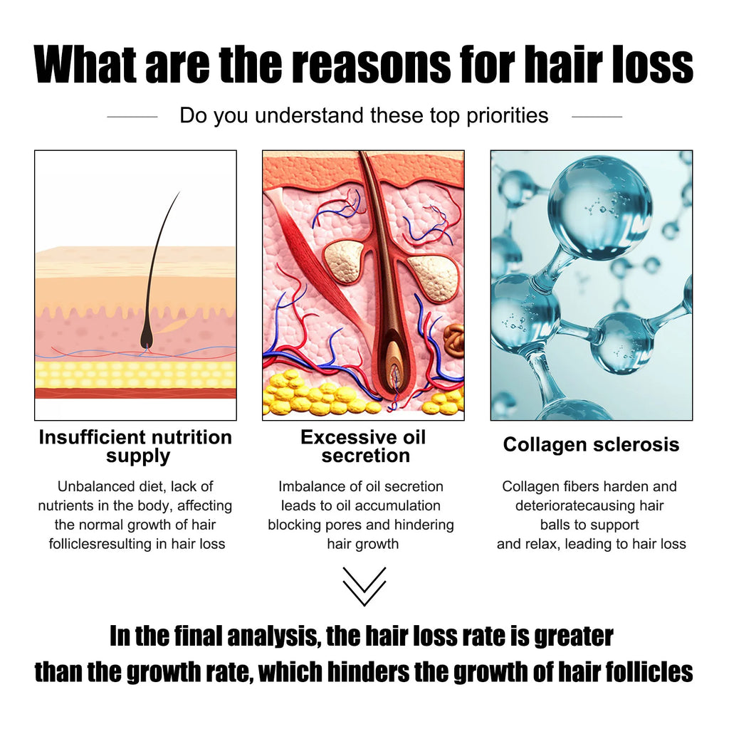 East Moon Vitamin E Hair Growth Oil – 30ml Hair Regrowth & Root-Strengthening Serum for Men