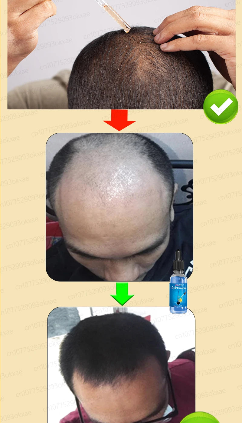 Blue Bottle Hair & Scalp Essential Oil – Thicker-Looking Hair Support