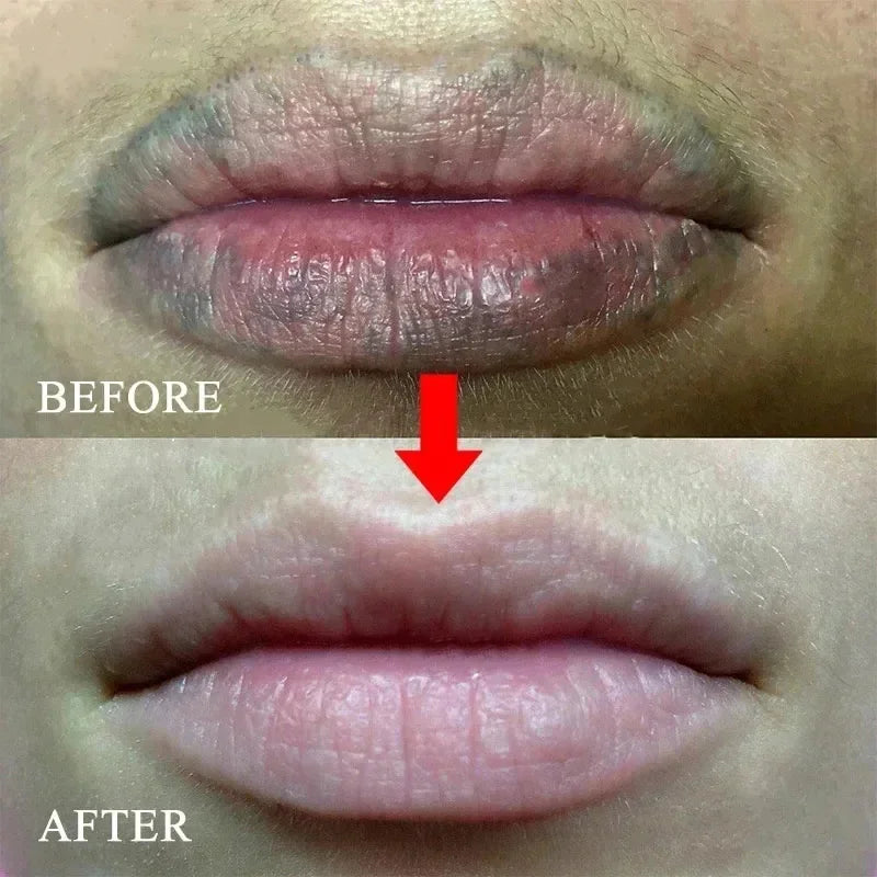 Remove Dark Lip Balm Moisturizing Lighten Melanin Bleaching Lip Gloss Lip Pink Lipstick Exfoliating Fade Lip Line Beauty Health