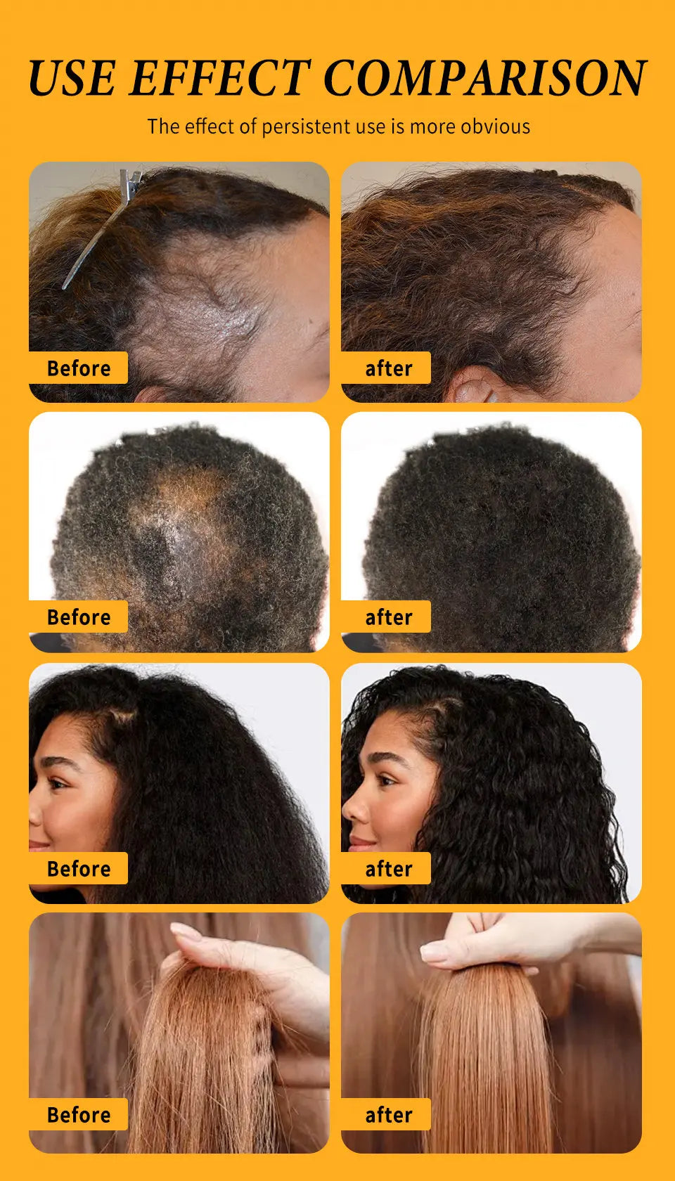 Fast Hair Growth Set Batana Oil Traction Alopecia Hair Mask Anti Break Loss Hair Growth Oil Baldness Treatment Hair Health Care