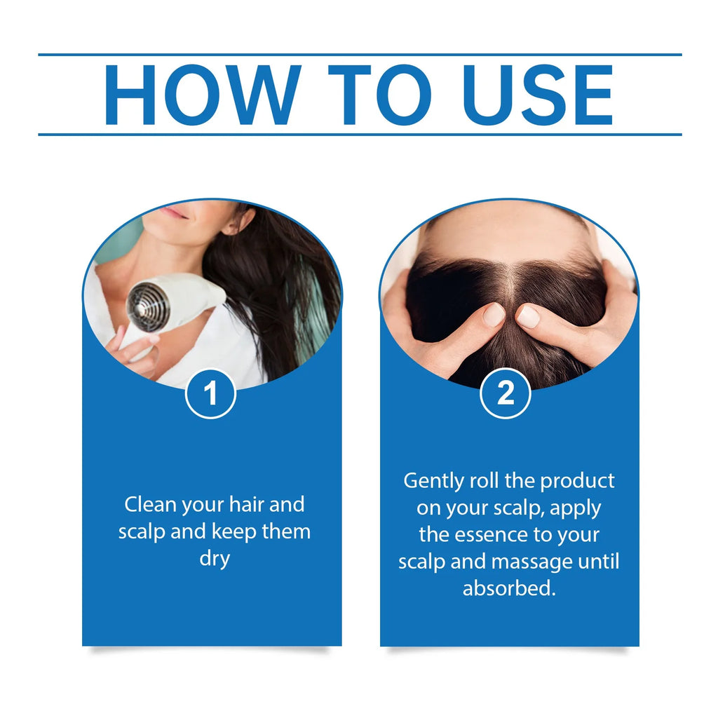 Rosemary Scalp Roller Serum – Breakage Support & Healthy-Looking Density (25ml)