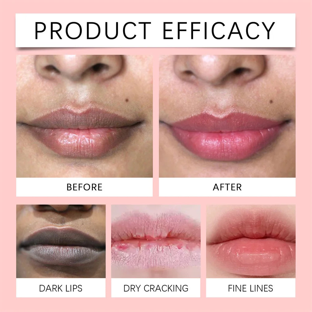 Remove Dark Lip Balm Fast Lightening Pink Lip Exfoliating Fade Lip Line Dead Skin Moisturizer Korean Care Products Beauty Health