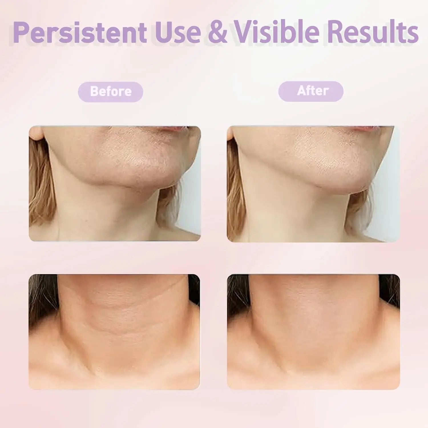 Red Light LED Facial Massager IPL Skin Rejuvenation Neck Lifting Tightening Machine Face Beauty Device Double Chin Remover