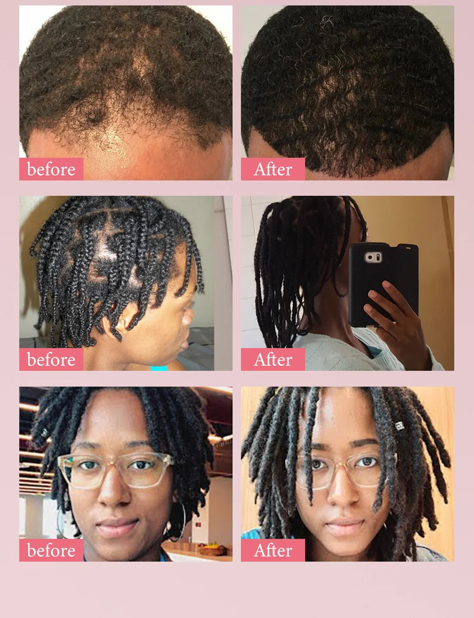 Sevich KARKAR Hair Butter – 100% Pure Natural Chebe & Kaka Oil Hair Growth & Repair Treatment (60g)