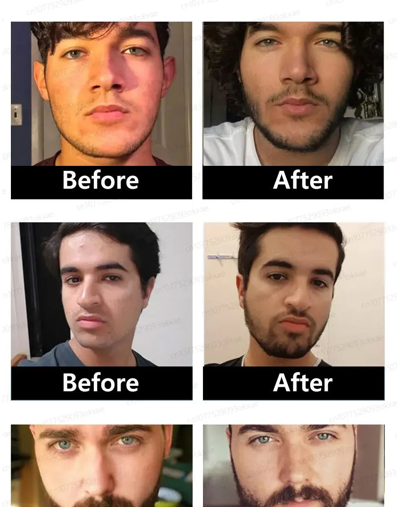 Beard & Hair Growth Essence – Root Care Serum (30ml)