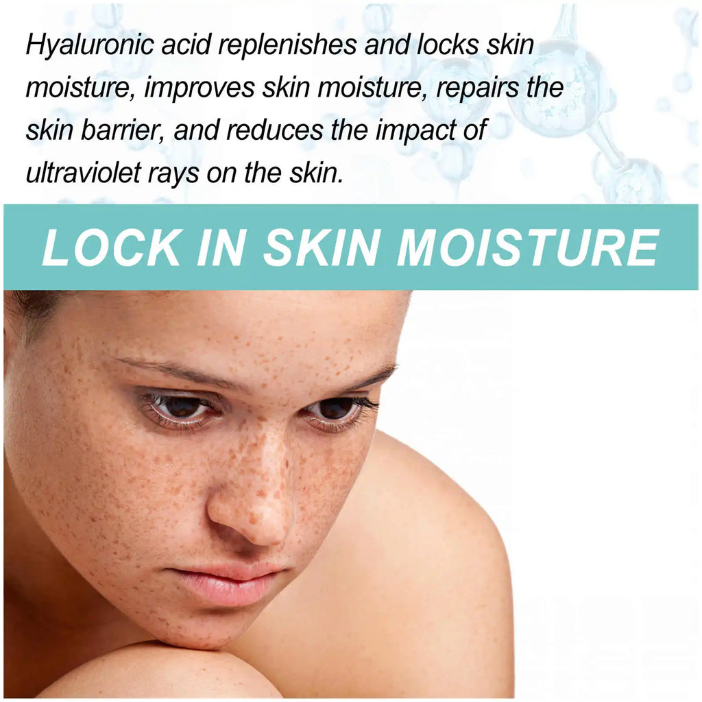 EELHOE Whitening Freckle Cream Nicotinamide Dark Spot Remover Skin Care Moisturizing Brighten Anti-aging Fade Spot Face Beauty