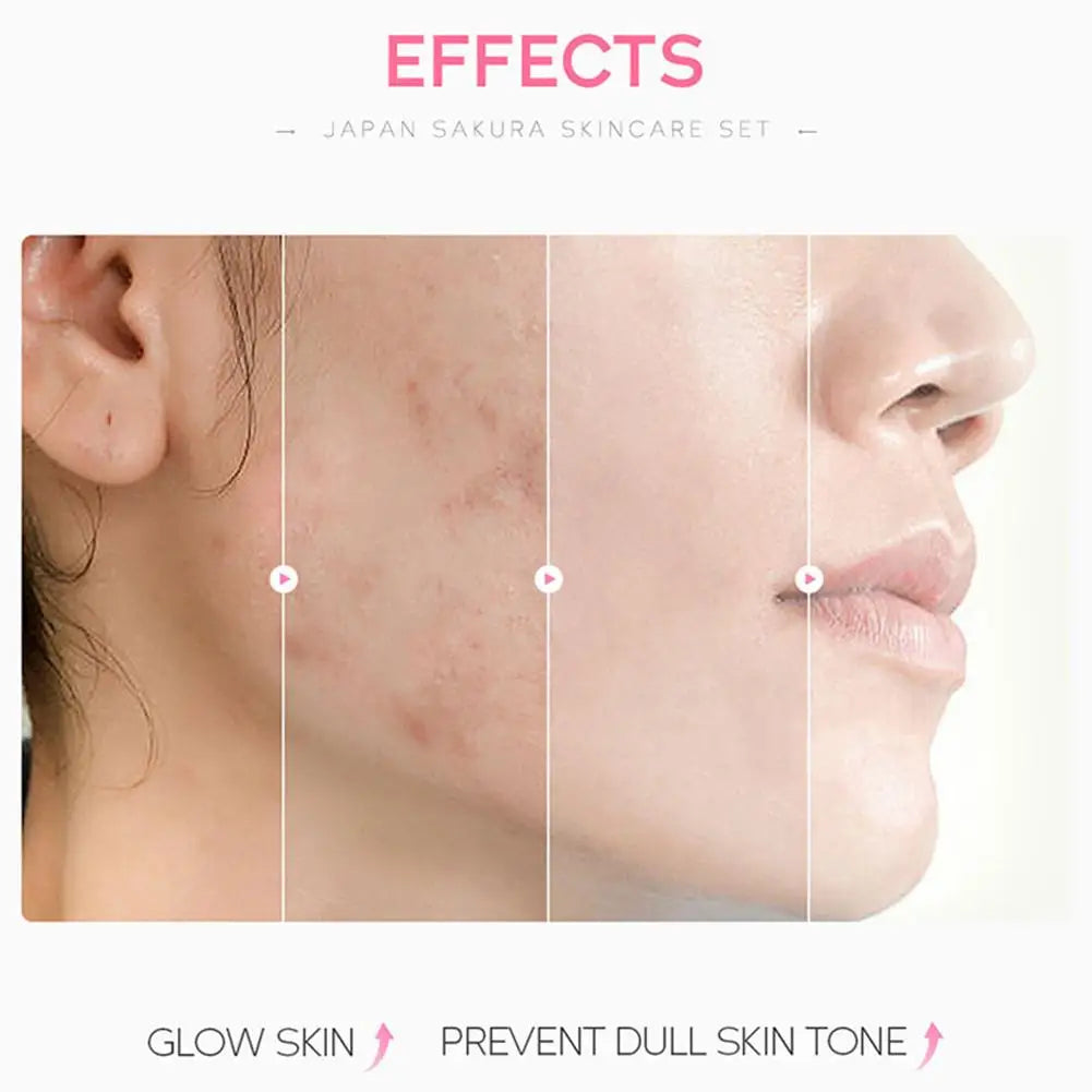 LAIKOU Sakura Skincare Gift Set – Moisturizing Face Care Kit (3–5 pcs)