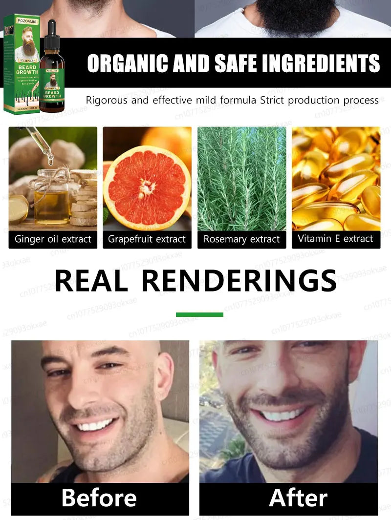 Beard & Hair Growth Essence – Root Care Serum (30ml)