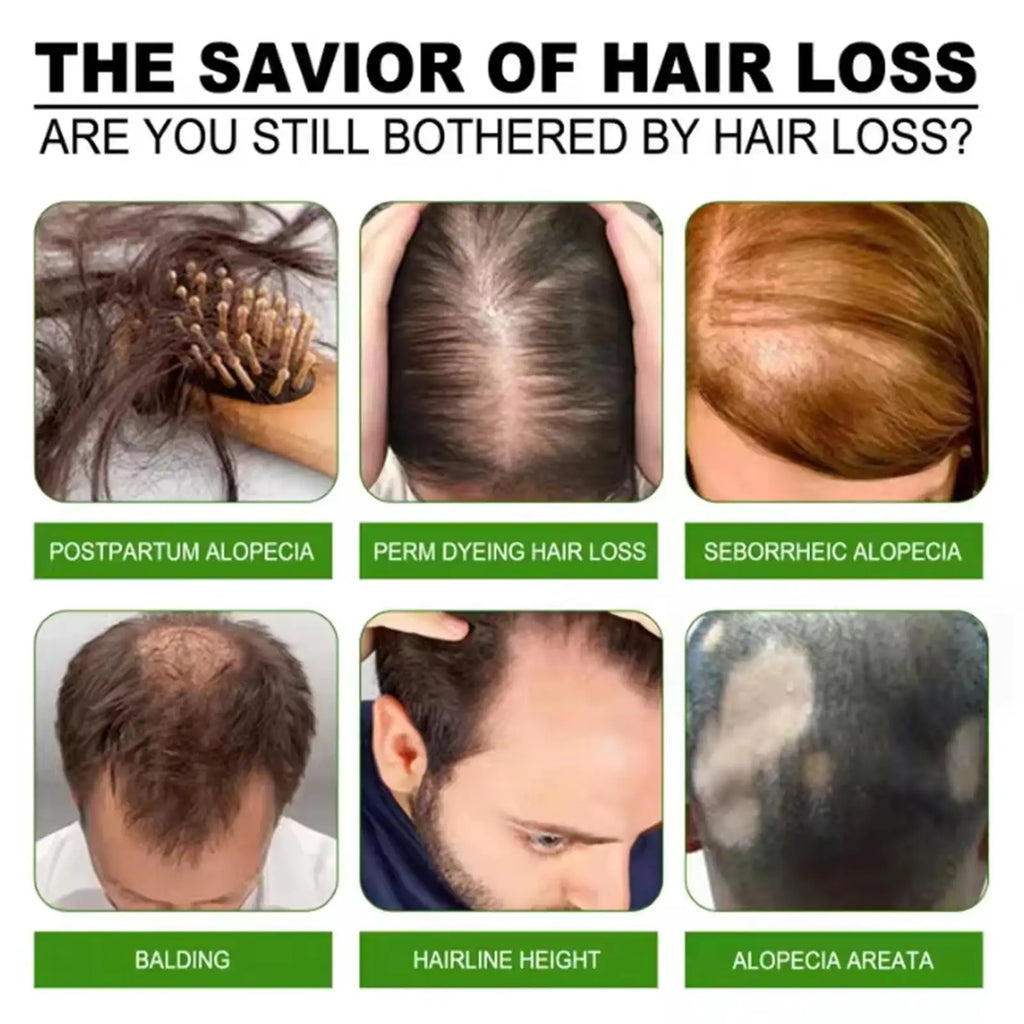 Batana Oil Hair Growth Set – Lightweight Root & Scalp Care (30ml)