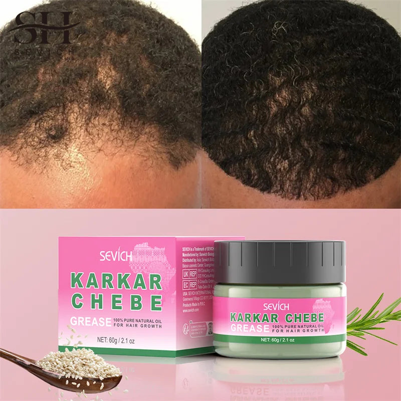 Sevich KARKAR Hair Butter – 100% Pure Natural Chebe & Kaka Oil Hair Growth & Repair Treatment (60g)