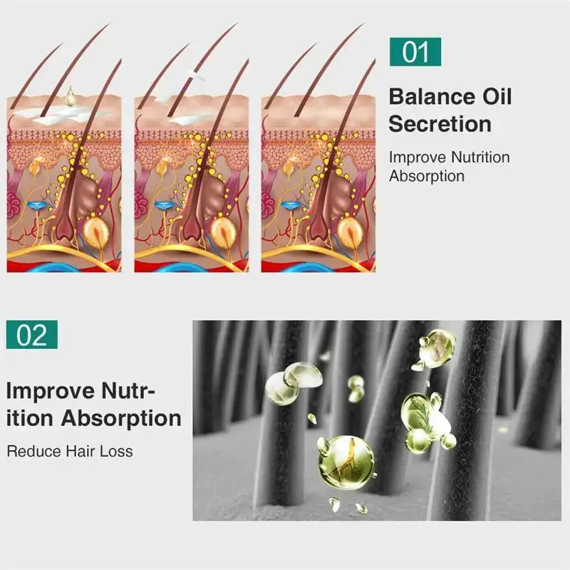 Ginger Scalp Nourishing Serum – Root Care Essential Oil (30ml)