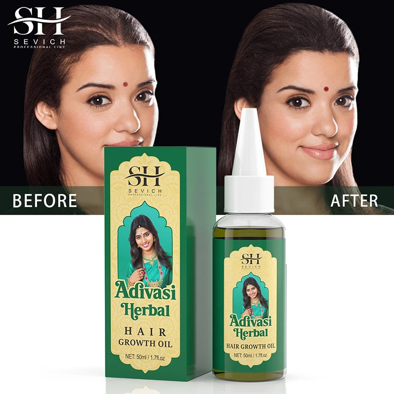 Sevich Ayurvedic Hair Growth Oil – 50ml Adivasi Organic Coconut Oil Serum for Fast Regrowth & Anti-Hair Loss
