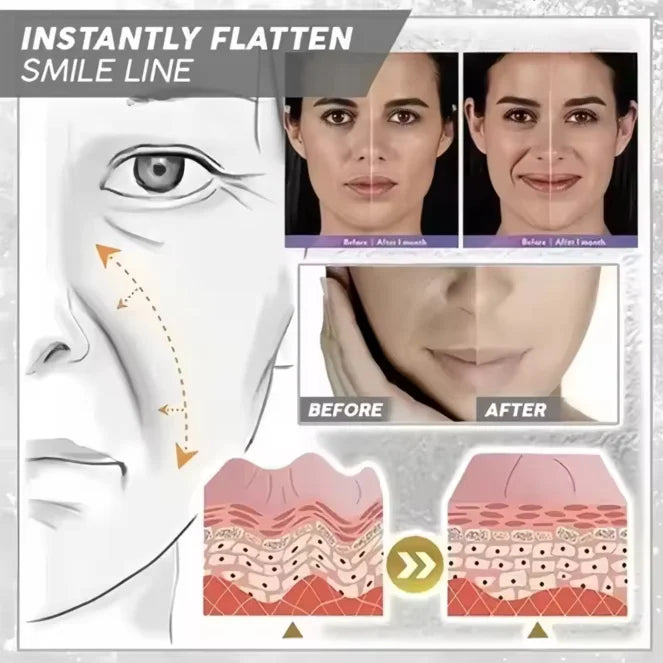 Collagen Moisturizer Cream – Hydrating Formula with Salicylic Acid