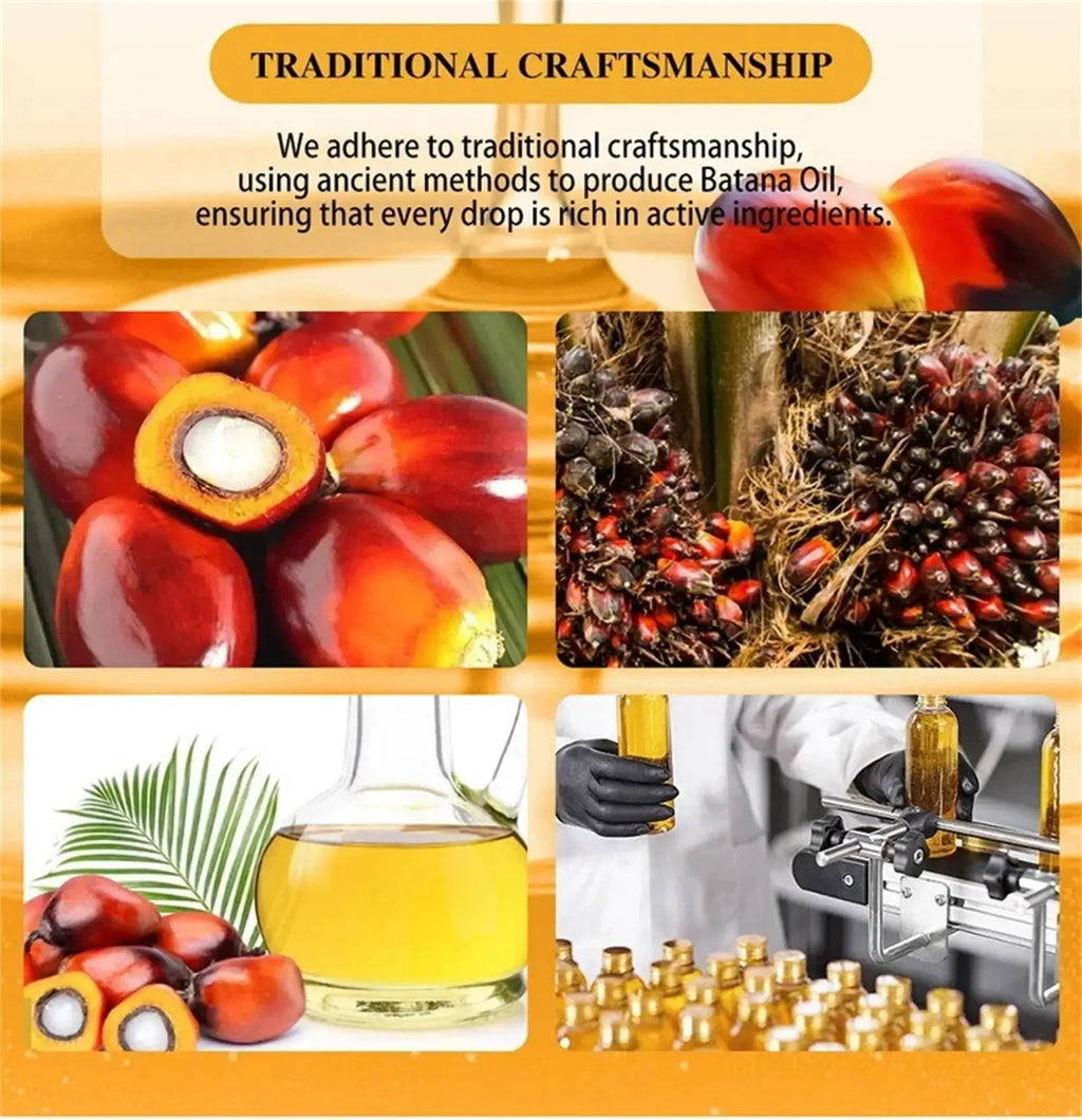 Fast Hair Growth Set Batana Oil Traction Alopecia Hair Mask Anti Break Loss Hair Growth Oil Baldness Treatment Hair Health Care