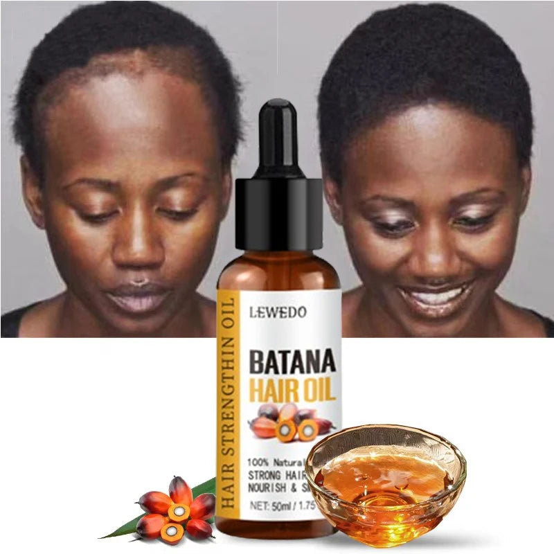 Lewedo Naturals Pure Batana Oil – 50ml Fast Hair Growth & Anti-Hair Loss Treatment for Men and Women