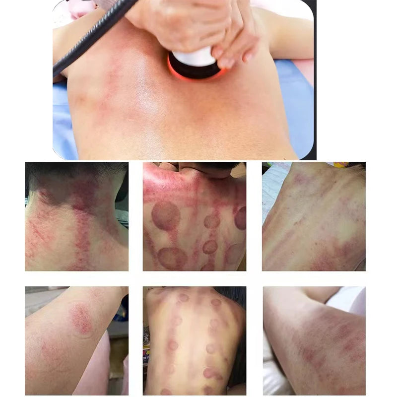 4 In 1 40k Cavitation Ultrasonic Body Care Tool – Versatile At-Home