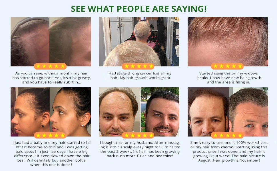 Fast Hair Growth Set Batana Oil Traction Alopecia Hair Mask Anti Break Loss Hair Growth Oil Baldness Treatment Hair Health Care