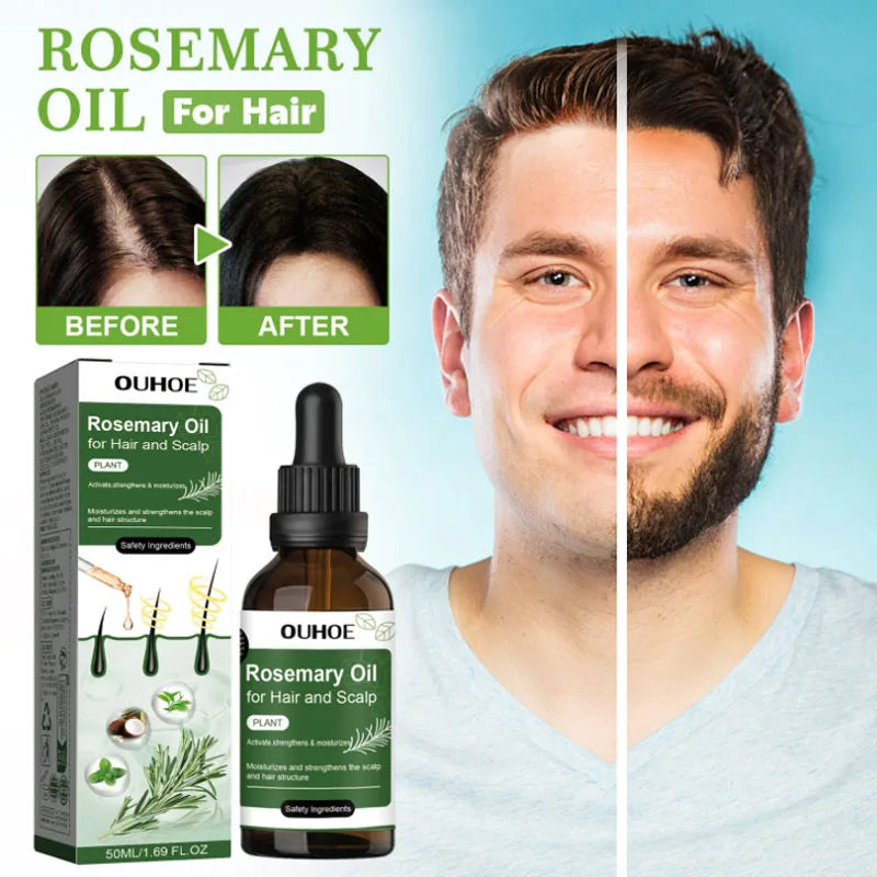 Rosemary + Mint Hair & Scalp Oil – Lightweight Root-Nourishing Blend (50ml)