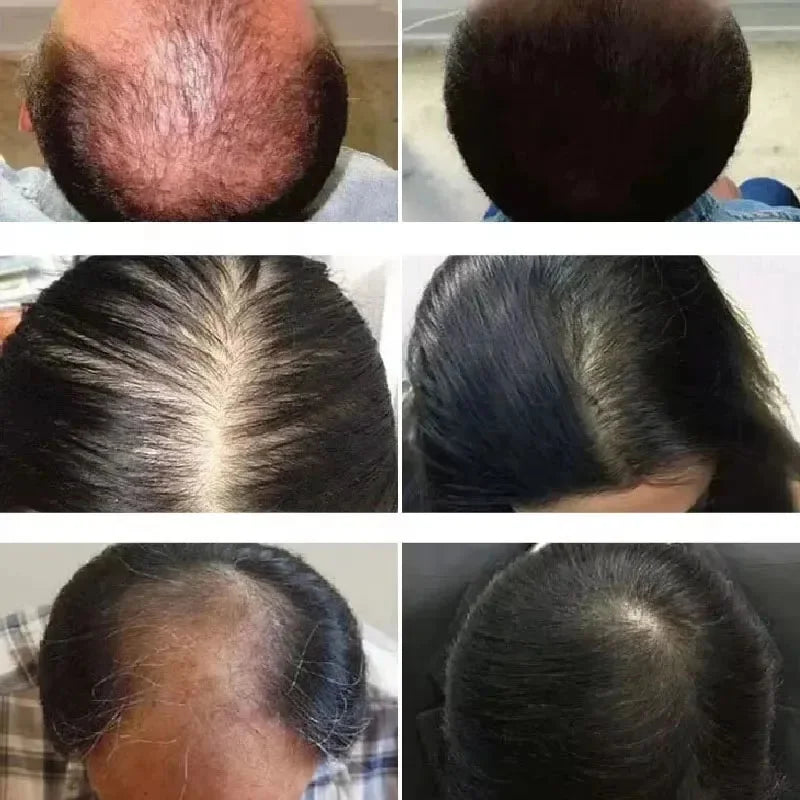 Rosemary + Mint Hair & Scalp Oil – Lightweight Root-Nourishing Blend (50ml)