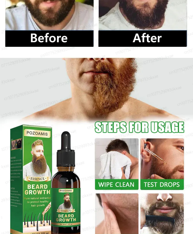 Beard & Hair Growth Essence – Root Care Serum (30ml)