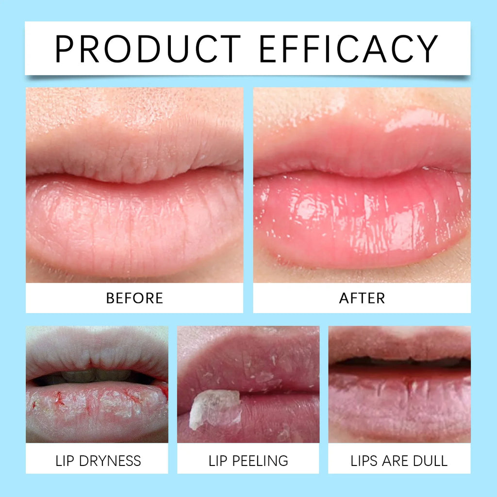 Remove Dark Lip Balm Fast Lightening Pink Lip Exfoliating Fade Lip Line Dead Skin Moisturizer Korean Care Products Beauty Health