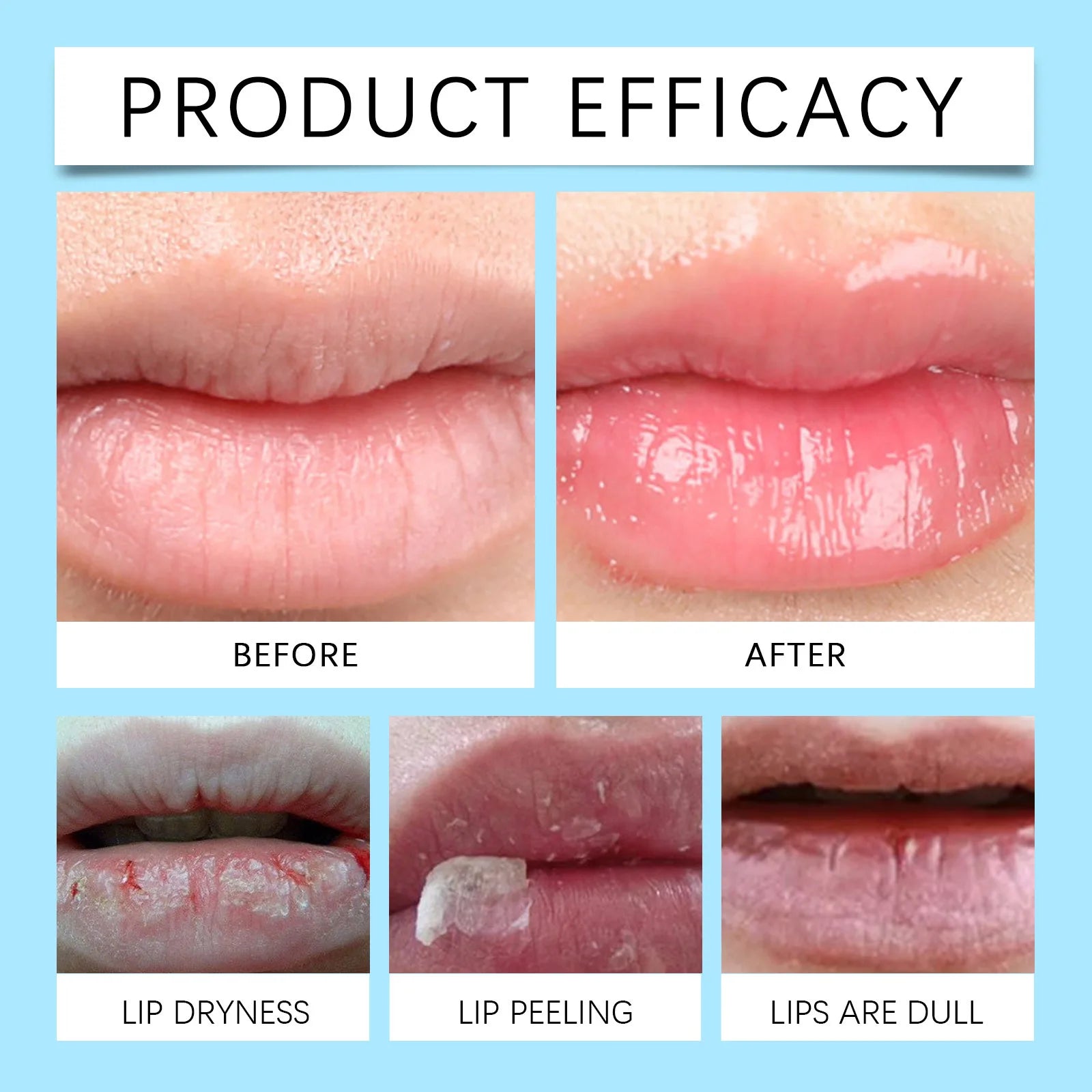 Remove Dark Lip Balm Fast Lightening Pink Lip Exfoliating Fade Lip Line Dead Skin Moisturizer Korean Care Products Beauty Health